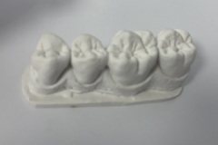 cabinet-stomatologic-optimum-dent-tg-frumos-11