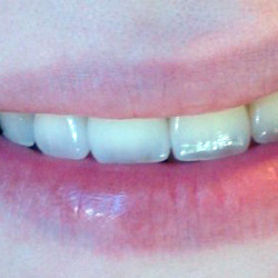 Estetica dentară