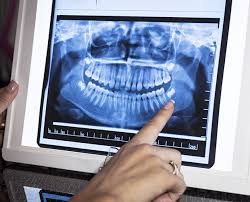 Radiologie dentară digitală de ultimă generație